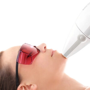 Depilazione Laser Permanente